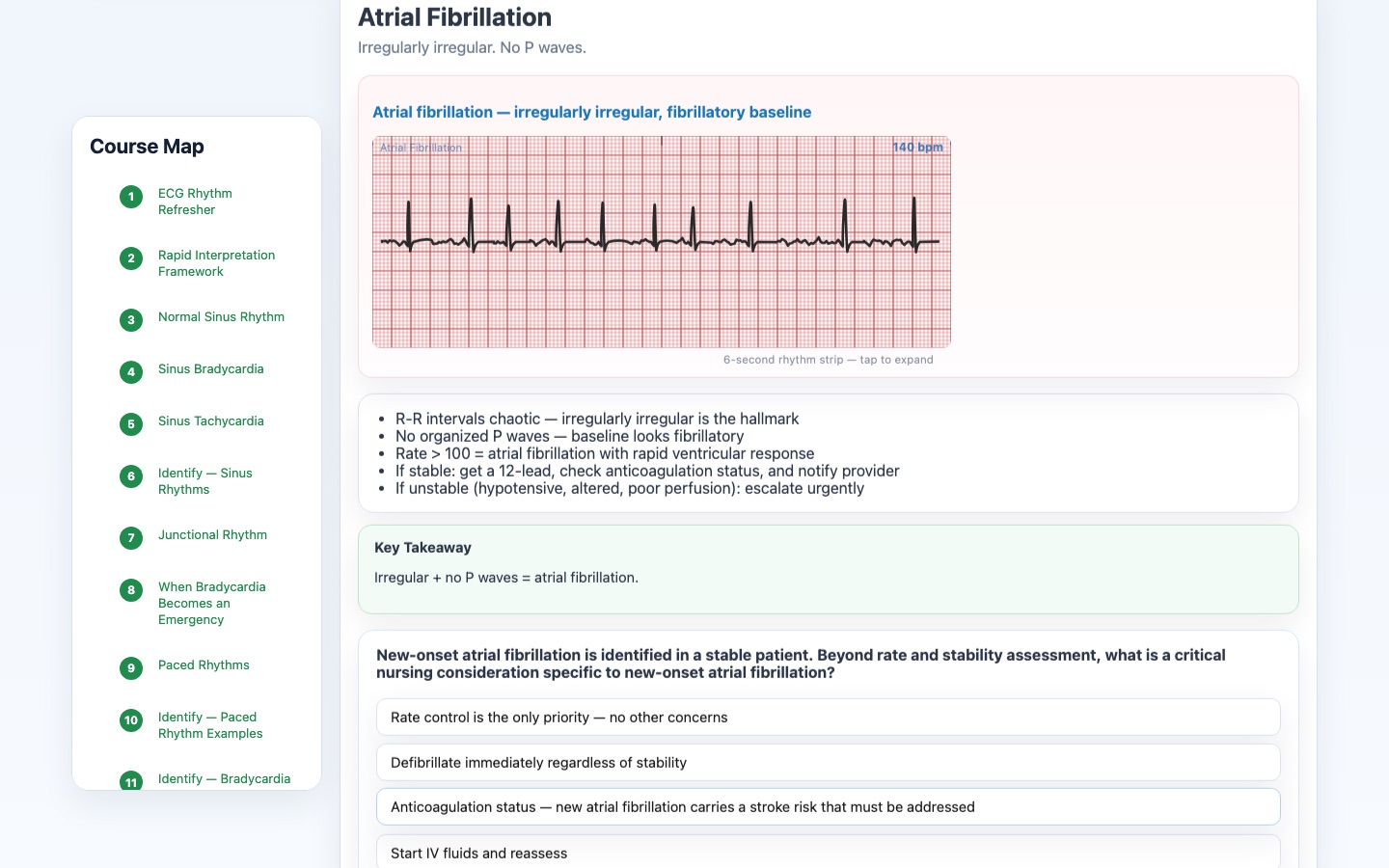 ECG rhythm practice screen
